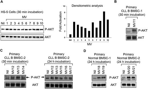 Figure 3. MVs activate human bone marrow stromal cells. (A) MVs isolated from different CLL patients' plasma exhibiting variable degrees of AKT activation in HS-5 cell line as determined by densitometric analysis of the results from Western blot. (B-D) MVs activate primary BMSCs isolated from CLL or healthy human subjects as analyzed by Western blot. A sustained level of AKT activation is detected at least up to 24 hours after incubation with MVs.
