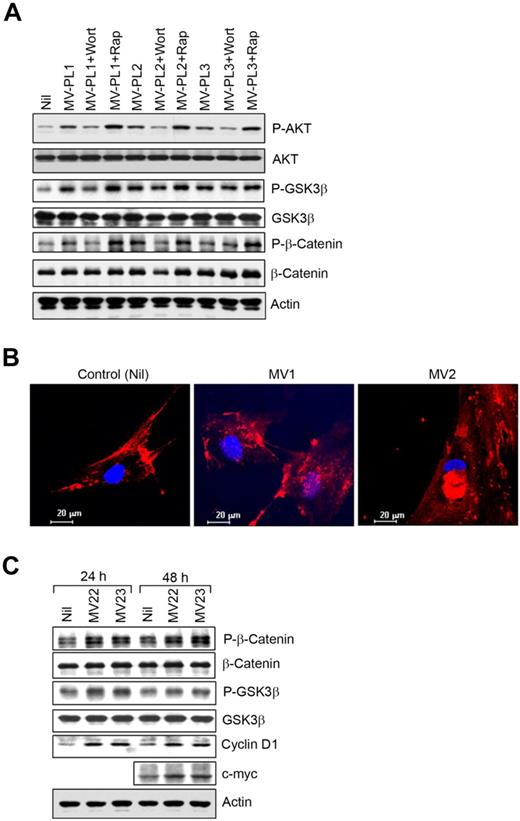 Figure 6. MVs modulate GSK3β/β-catenin signaling in BMSCs. (A) The BMSC lysates stimulated with MVs described in Figure 4A were analyzed for AKT-mediated phosphorylation of GSK3β and β-catenin at Ser552 by Western blot by the use of specific antibodies. Phosphorylation of AKT is also shown for comparison. (B) Translocation of β-catenin was visualized in BMSCs stimulated with MVs from CLL patients (MV1 and MV2) by the use of a specific antibody to β-catenin and nuclear stain, DAPI under confocal microscope (magnification level is indicated by the horizontal bar). (C) AKT-mediated phosphorylation of β-catenin at Ser552 and GSK3β was further examined in BMSCs stimulated with MVs for 24 or 48 hours by Western blotting. Expression of cyclin D1 and c-myc, downstream targets of GSK3β/β-catenin, was shown in BMSCs after stimulation with MVs (MV22 and MV23) compared with the unstimulated controls in Western blot analysis.