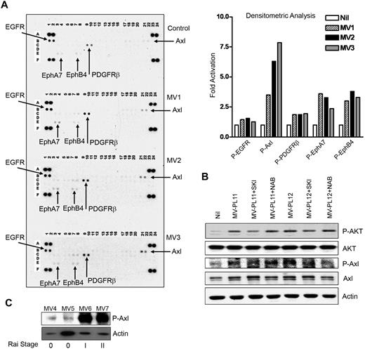 Figure 7. MVs activate RTKs in BMSCs. (A) Activation of RTKs in BMSCs stimulated with MVs obtained from CLL patients at Rai stages 0 (MV1), I (MV2), or II (MV3) was analyzed on human phospho-RTK antibody array blots and the level of activation compared with the unstimulated control BMSCs. Activation of various RTKs was analyzed and presented as fold-activation by bar diagrams. (B) Lysates from BMSCs stimulated with MVs after treatment with the Axl-inhibitor, SKI-606 (SKI) or anti-VEGF neutralizing antibody (NAB) or left unstimulated or untreated were examined for the phosphorylation of AKT by Western blot. Treatment with SKI-606 showed substantial inhibition of MV-mediated activation of AKT; however, anti-VEGF antibody did not show any effect. Phosphorylation of Axl is also shown for comparison. Actin was used as loading control. (C) MVs obtained from CLL patients at various Rai stages (0, I, II) were analyzed for the presence of constitutively active Axl by Western blot with the use of a phospho-specific antibody to Axl. Actin was used as loading control.