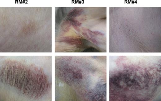 Figure 1. Dengue hemorrhage in rhesus monkeys. Rhesus monkeys were intravenously infected with dengue virus as described in “Nonhuman primates, virus, and cells.” Hemorrhagic manifestations were captured with digital camera on days 3 (RM2), 4 (RM4), and 5 (RM3) after infection. Different severity of hemorrhage, ranging from petechiae to severe coagulopathy, was seen. A classic clinical hemorrhage was observed in infected animal RM4. The top and bottom panels indicate that the images of the skin hemorrhage were captured from different parts of the body within the same animal.