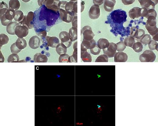 Figure 7. Engulfment of platelets by monocytes/macrophages. Blood smears were prepared from dengue virus–infected rhesus monkeys and Wright Giemsa and immunofluorescence stainings were performed. Images were acquired on a Zeiss AxioImager A1 epifluorescence microscope with an AxioCam MRC5 camera. Images were captured with a Zeiss 100×/1.3 Plan Neofluar oil objective lens and then processed with AxioVision Release 4.5 software. (A-B) Wright Giemsa staining revealed that tangled platelets were engulfed by monocytes. (C) Immunofluorescence staining revealed that some of these platelets were positive for dengue viral antigen (3H5, red). Nuclear was stained with DAPI (blue) and SYTOX Green.