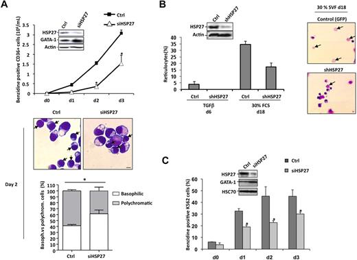 Figure 2. HSP27 depletion delays erythroid differentiation of human primary erythroblasts and K562 cells. (A) Human primary erythroblasts were induced to differentiate with Epo, IL-3,and TGFβ (2.5 ng/mL) after 24 hours of transfection with HSP27 siRNA (siHSP27) or control siRNA (Ctrl,) (20nM). Percentages of cell transfection and survival were approximately 60% to 70% and 80%, respectively. At the days indicated (day 0 to day 3) the percentage of differentiated cells was evaluated by benzidine assay. Insert, cell lysate from day 2 was resolved on a gel and blotted with the indicated antibodies. (Middle) Differentiating cells at day 2 were visualized by microscopy after cell fixation and staining with May-Grünwald-Giemsa (magnification ×40; bar, 10μm). → indicates polychromatic. One representative image is shown. (Bottom) Percentages of basophilic and polychromatic cells. Quantification, at day 2, from a total number of 300 cells in randomly chosen microscopic fields. (B) CD34+ cells, growing in presence of cytokines (IL-3, Epo), were transduced with shRNA specific for HSP27 or shRNA control (Ctrl). At day 5, CD36+ green fluorescent protein–positive (GFP+) cells were sorted and differentiated in the presence of 30% SVF or TGFβ (2.5 ng/μL) to allow the production of reticulocytes. (Insert) Western blot analysis of HSP27 expression after shRNA transduction. Actin serves as a loading control. Reticulocytes were quantified at the indicated times as the ratio of their number to a total number of 300 cells chosen randomly in different microscopic fields. (Right) Reticulocytes visualized by microscopy after cell fixation and staining with May-Grünwald-Giemsa (magnification ×20; bar, 10 μm). → indicates reticulocytes. Note that HSP27 siRNA and shRNA target different sequences of HSP27 mRNA. (C) Human K562 cells were induced to differentiate with hemin (40μM) after 24 hours of transfection with HSP27 siRNA (siHSP27; ) or scrambled (Ctrl; ). The percentage of differentiated cells was determined by benzidine assay. (Insert) Cell lysate from days 0 and 2 was resolved on a gel and blotted with the indicated antibodies.