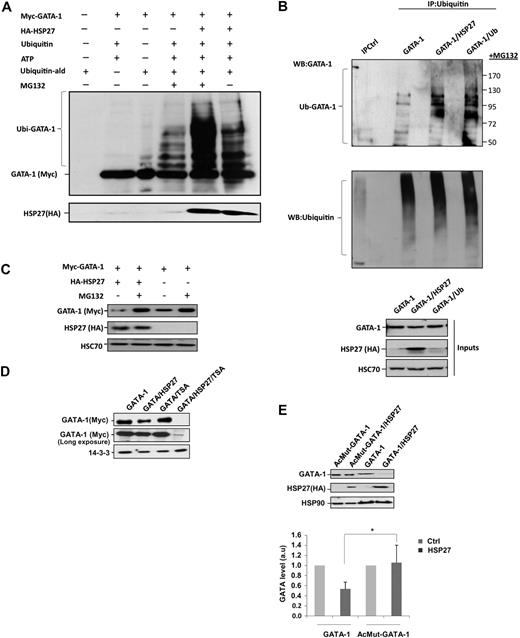 Figure 4. HSP27 induces GATA-1 ubiquitination and proteasomal degradation. (A) Recombinant GATA-1 protein, generated with TNT T7-coupled reticulocyte lysate system, was incubated in the presence or absence of recombinants ubiquitin (Ub) and HSP27 for 40 minutes in an ubiquitin buffer, as described in “In vitro ubiquitination assay.” The reaction was stopped with Laemmli buffer, run on a gel, and blotted with the Myc-tag (GATA-1) antibody. The smear corresponds to the different forms of ubiquitinated GATA-1. (B) K562 cells were transiently transfected with GATA-1 alone or GATA-1 to together with a HSP27 or an ubiquitin construct. Cells were treated 5 hours with MG132, and then lysates were immunoprecipitated with an agarose-conjugated multiubiquitin antibody followed by a Western blot with a GATA-1 antibody. Control for immunoprecipitation (IPCtl) corresponds to a mix of nonrelevant immunoglobulin G and protein G in the presence of lysate. Inputs: protein expression in total extracts (40 μg). (C) HeLa cells were transiently transfected with HA-HSP27 and Myc-GATA-1 plasmids and treated or not with MG132 (20μM, 5 hours). GATA-1 content was analyzed by immunoblot. (D) HeLa cells were transiently transfected with Myc-GATA-1 or with both Myc-GATA-1 and HA-HSP27. Cell extracts from cells either left untreated or treated with trichostatin A (300nM, 16 hours) were resolved on a gel and immunoblotted with Myc-tag (GATA-1). (E) HeLa cells were transiently transfected with Myc–GATA-1 or the acetyl mutant GATA-1 (AcMut-GATA-1) in the presence or absence of HA-HSP27. After 24 hours of transfection, expression of GATA-1 and HSP27 was assessed by Western blot. (Bottom) Densitometry analysis to quantify HSP27-induced degradation of GATA-1. One representative blot of 3 performed is shown. HSP90, HSC70, and 14-3-3 are loading controls.