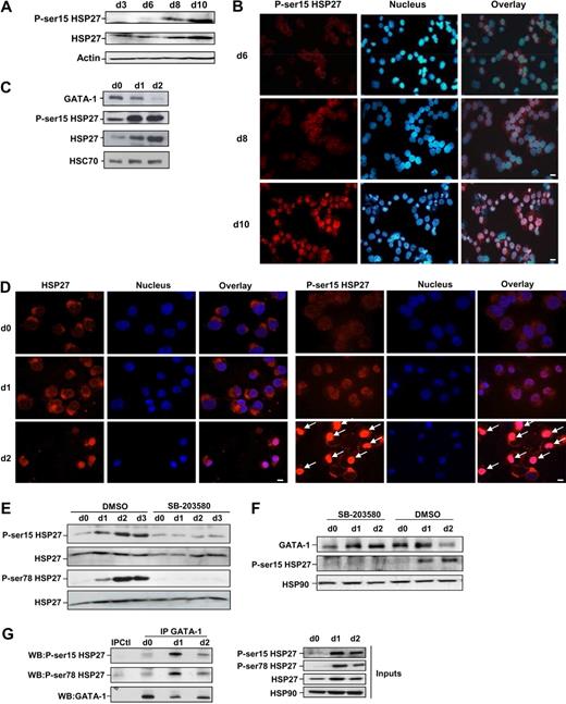 Figure 6. HSP27 phosphorylation is required for its association with GATA-1 and to induce GATA-1 degradation. (A) Human primary CD36+ erythroblasts were induced to differentiate in the presence of IL-3, and Epo. Phosphorylated HSP27 expression (on S15) was assessed at the indicated days by Western blotting. Actin serves as a loading control. (B) Localization of S15-phosphorylated HSP27 during Epo-induced CD36+ differentiation. Immunofluorescence was performed as described in “Methods.” Nuclei were stained with Hoechst 33342 (1 μg/mL). Magnification ×40; bar, 10 μm. (C) Phosphorylated HSP27 (on S15) was determined by Western blot in K562 erythroid cells treated with hemin. HSC70 serves as loading control. (D) Localization by immunofluorescence studies of S15-phosphorylated HSP27 during hemin-induced K562 differentiation (days 0-2). Magnification ×40; bar, 10 μm. Arrows indicate nuclear localization of phosphorylated HSP27 (E) Phosphorylated HSP27 (both on S15 and S78) was determined in lysates from K562 cells induced to differentiate with hemin (day 0 to day 3) in the presence or absence of the p38MAPK pathway inhibitor SB-203580 (20μM). (F) GATA-1 level was determined in lysates from K562 cells induced to differentiate with hemin (day 0 to day 2) in the presence or absence of the p38MAPK pathway inhibitor SB-203580 (20μM). (G) At the indicated days after hemin treatment of K562 cells, GATA-1 was immunoprecipitated followed by immunoblotting with P-Ser15-HSP27 and P-Ser78-HSP27 antibodies. IPCtl, immunoprecipitation with a nonrelevant antibody and G protein. HSP90 serves as a loading control. Inputs: protein expression in total extracts (40 μg). DMSO indicates dimethyl sulfoxide.