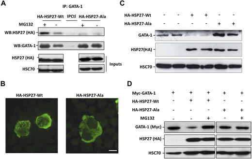 Figure 7. A nonphosphorylatable mutant of HSP27 does not localize in the nucleus and does not bind to GATA-1 to induce its degradation. (A) K562 cells transiently transfected with HA-HSP27-Wt, HA-HSP27-Ala, or a control vector, treated or not with MG132 (20μM, 5 hours), were immunoprecipitated with GATA-1 before immunoblotting with HSP27 (HA) and GATA-1 antibodies. IPCtl, immunoprecipitation with a nonrelevant antibody and G protein. Inputs: protein expression in total extracts (40 μg). (B) K562 cells were transiently transfected with HA-HSP27-Wt and HA-HSP27-Ala. Localization of the transfected HSP27 forms was determined by immunofluorescence after 24 hours of hemin treatment. (Magnification ×100; bar, 10 μm). (C) GATA-1 content was determined by Western blot in duplicate in K562 cells expressing a control vector, HA-HSP27-Wt, or HA-HSP27-Ala. (D) GATA-1 content was determined by Western blot in HeLa cells stably overexpressing HA-HSP27-Wt, HA-HSP27-Ala, or a control vector and transiently transfected with Myc-GATA-1. When indicated, cells were treated with MG132 (20μM, 5 hours). HSC70 was used as a loading control.