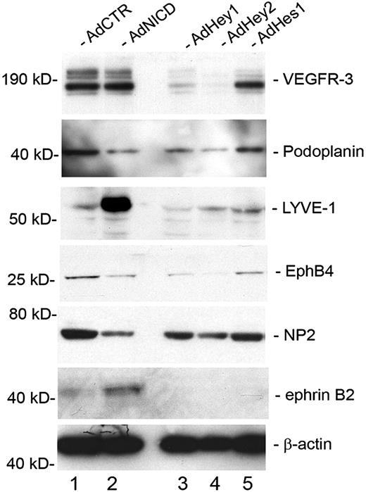 Figure 5. Regulation of lineage-specific gene expression by Notch signal proteins in primary LECs. Western blot analyses showing the expression of vascular markers for lymphatic (VEGFR-3, podoplanin, LYVE-1), venous (EphB4, NP-2), and arterial (ephrinB2) endothelial cells in primary LECs that were transduced with a control (AdCTR), NICD (AdNICD), Hey1 (AdHey1), Hey2 (AdHey2), or Hes1 (AdHes1)–expressing adenovirus for 48 hours.