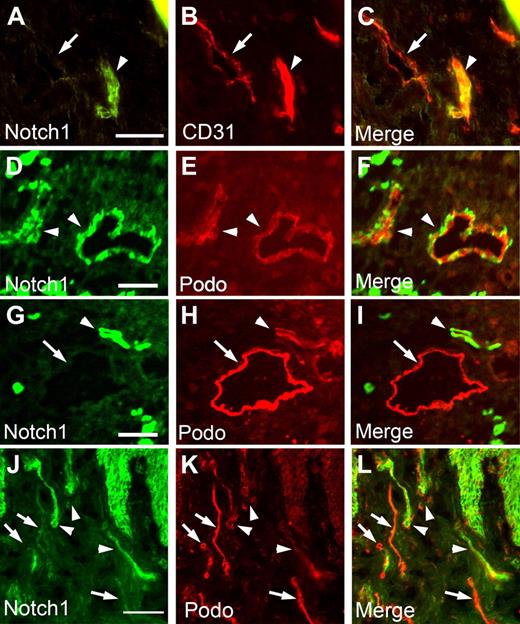 Figure 7. Inverse correlation between the expressions of Notch receptor and podoplanin in postdevelopmental human cutaneous lymphatics. Human neonatal foreskin sections were stained for Notch1 (A,D,G,J) and CD31 (B) or podoplanin (E,H,K). Merged images are shown (C,F,I,L). (A-C) Arrowhead indicates a CD31-high, Notch-high blood vessel, and arrow points to a CD31-low, Notch-low lymphatic vessel. (D-L) All arrowheads mark Notch-high, podoplanin-low lymphatic vessels, and all arrows indicate Notch-low, podoplanin-high lymphatic vessels. Note the inverse correlation in the expression levels of Notch versus podoplanin in panels I and L. Bars represent 100 μm. Fluorescent images were acquired using a Zeiss microscope with a 63× objective and processed with AxioVision Digital Imaging software.