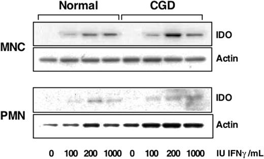 Figure 1. CGD monocytes and PMN express IDO after IFNγ treatment. Immunoblots of lysates from monocytes (MNC) or PMN treated with indicated doses of IFNγ were probed for indoleamine 2,3-dioxygenase (IDO) expression and β-actin as a loading control. Blots shown are representative of 2 experiments.
