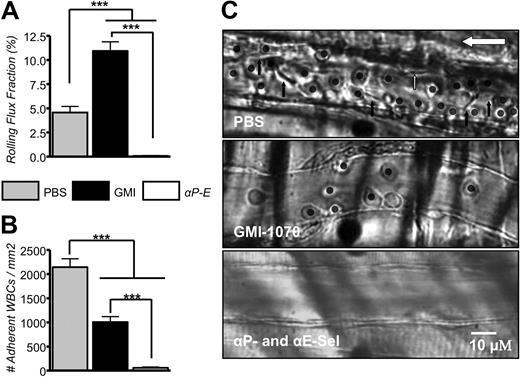 Figure 4. GMI-1070 alters leukocyte recruitment. (A) The rolling flux fraction was increased by nearly 2-fold in SCD mice treated with GMI-1070, whereas it was completely inhibited when both endothelial selectins were blocked by antibody administration. (B) The average number of leukocytes adherent to endothelium was significantly reduced in SCD mice treated with GMI-1070 but completely inhibited by antiselectin antibodies. (C) Representative images of venules from sickle mice treated with PBS, GMI-1070, or anti–P- and –E-selectin antibodies. Each still frame was taken at the 30-minute time point after TNF-α injection. Both small molecule selectin antagonists and antiselectin antibodies significantly reduced the number of adherent leukocytes (circles) and RBCs interacting with adherent leukocytes (black arrows; see data in Figure 5). The small white arrow indicates an RBC interaction with the endothelium, and the large white arrow shows the direction of blood flow.