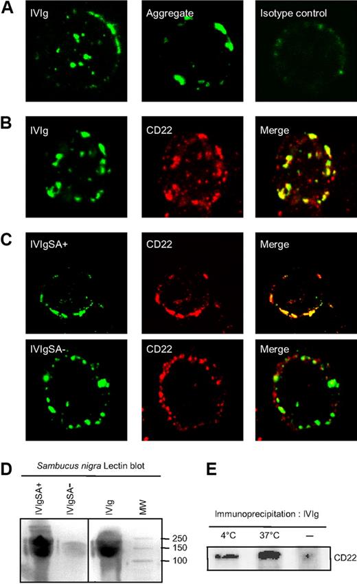 Figure 3. IVIg binds to CD22 on the surface of B cells. (A) Tonsillar B cells were incubated with IVIg (left panel), or with aggregate IgG (middle panel). The binding of IgG was revealed using FITC-conjugated goat Fab′2 anti–human IgG. The right panel shows binding of the secondary Ab alone with the TRITC-conjugated donkey anti–rabbit IgAb, used as negative control. (B) Tonsillar B cells were stained with rabbit anti-CD22 followed by TRITC conjugated anti–rabbit Ab. After several washes, the cells were incubated with IVIg and and followed by FITC-conjugated anti–human IgG F(ab′)2. (C) Sialylated IVIg (IVIg SA+) and asialylated (IVIg SA−) fractions were used to stain B cells followed by FITC-conjugated F(ab′)2 anti–human IgG antibody. B cells were also stained with anti-CD22. (D) IVIg was separated according to their SA content using SNA affinity chromatography. Purity of the fractions was assessed by lectin blotting. Staining for CD22 was followed by secondary HRP-conjugated Ab, and the blots developed using the ECL system. (E) Tonsillar B cells were incubated with IVIg before warming the cells up at 37°C (middle lane) or examined without warming (left lane). Control for warming up at 37°C without IVIg is also shown (right lane) is shown. After the incubation, cell lysates were prepared and immunoprecipates with protein G Sepharose beads and analyzed by WB using anti–human CD22 Ab followed by secondary HRP conjugated Ab. The blots were developed using the ECL system.