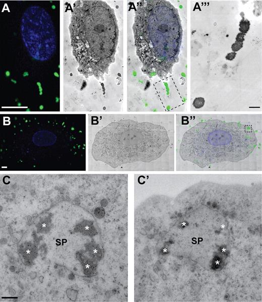 Figure 2. Correlative fluorescence and transmission electron microscopy of VWF dots. HUVECs were stimulated for 20 minutes with 80nM PMA in the presence of FITC-conjugated anti-VWF antibodies to detect extracellularly accessible VWF. (A-A‴) Examples of VWF dots correlated with electron-dense, round-shaped structures outside the cell. (A) Fluorescence micrograph of a HUVEC showing VWF immunofluorescence in green and DAPI in blue. Scale bar represents 10 μm. (A′) Electron micrograph of the cell shown in panel A. (A″) Overlay of the immunofluorescence and electron microscopic images shown in panels A and A′. (A‴) Higher magnification TEM view of the VWF dots in the boxed area in A″. Scale bar represents 1 μm. (B-B″) Example of a cluster of VWF dots correlated with electron-dense, round-shaped structures inside the cell. (B) Fluorescence micrograph of a HUVEC showing VWF immunofluorescence in green and DAPI in blue. Scale bar represents 10 μm. (B′) Electron micrograph of the cell shown in panel B. (B″) Overlay of the immunofluorescence and electron microscopic images shown in panels B and B′. (C-C′) Electron micrographs of 2 consecutive sections corresponding to the boxed area in panel B″, revealing that the cluster of electron-dense VWF dots (asterisks) is contained within a vesicular structure (secretory pod, SP). Scale bar represents 500 nm. Fluorescence images were acquired with a Leica TCS SP5 confocal laser-scanning microscope and a 63× oil-immersion objective with a numeric aperture of 1.4 (Leica HCX Plan APO). Electron micrographs were acquired with an FEI Tecnai 12 TEM at 120 kV and using an FEI Eagle 4kx4k CCD camera.