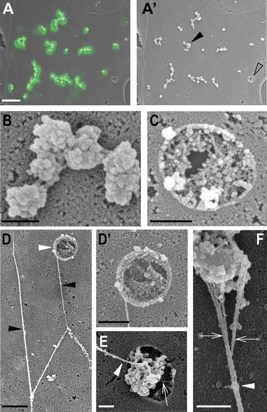 Figure 3. Correlative fluorescence and scanning electron microscopy of VWF dots. HUVECs were stimulated for 20 minutes with 80nM PMA in the presence of FITC-conjugated anti-VWF antibodies to detect extracellularly accessible VWF. (A-A′) Overlay of a correlated VWF fluorescence and scanning electron microscopy (SEM) micrograph of part of a HUVEC, revealing that the VWF immunofluorescence (in green) corresponds to globular structures on the cell surface. Scale bar represents 5 μm. (A′) SEM micrograph of the same area shown in panel A. Cell surface areas containing clusters of VWF dots often contained one or more pores (open arrowhead). (B) Higher magnification of a cluster of VWF dots indicated by the black arrowhead in panel A′. Scale bar represents 500 nm. (C) Higher magnification of the pore indicated by the open arrowhead in panel A′. Notice the clearly defined rim of the pore. Scale bar represents 500 nm. (D-D') When anti-VWF antibodies are omitted during secretagogue challenge, long VWF strings are found on the surface of the cells. (D) Typical example of branching VWF strings (black arrowheads) forming a network. Note the pore (white arrowhead) from which a VWF string emanates. Scale bar represents 1 μm. (D′) Close-up of the secretion pore shown in panel D. Scale bar represents 500 nm. (E) Close-up of another secretion pore releasing globular material and a VWF string (white arrowhead). Pore in the membrane showing globular material and a filament (white arrowhead). The filament appears to arise from the globule. Small filamentous material is also present in the pore (arrow). Scale bar represents 500 nm. (F) High magnification view of a VWF string and associated globule. The string (arrowhead) consists of several entwined filaments (arrows) forming a bundle. Scale bar represents 500 nm. The fluorescence micrograph was acquired using a Leica SP2 confocal laser-scanning microscope and a 63× oil-immersion objective with a numeric aperture of 1.33 (Leica PL APO). Scanning electron micrographs were made with a JEOL JSM-6700F field emission scanning electron microscope at 5.0 kV.