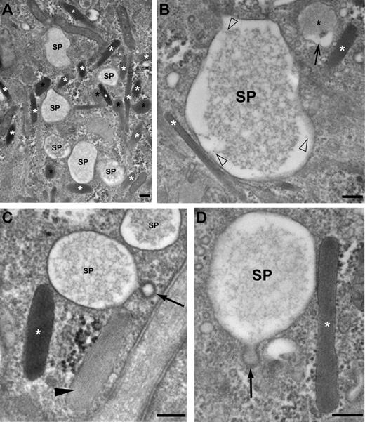 Figure 4. Morphologic characterization of secretory pods visualized by TEM. (A) Low magnification view showing a cluster of SPs and WPBs (white asterisks). Some WPBs have rounded up (black asterisks). (B) An SP displaying a core of lacy material that is connected to the delimiting membrane of the SP by short filaments (open arrowheads). A WPB (white asterisk) makes contact with the SP (bottom left). A rounded WPB (black asterisk) displays an electron lucent area interposed between the delimiting membrane and the matrix (small arrow). (C) A clathrin-coated vesicle (small arrow) is connected to the secretory pod (SP) by a small neck. Note that the WPB labeled with the white asterisk has a denser content than the WPB indicated with an arrowhead. (D) Another example of an SP displaying signs of membrane retrieval (clathrin-coated pit, arrow) and in close contact with a WPB (white asterisk). Note that the membrane of the WPB is electron denser at the interface with the SP, while the delimiting membrane of the SP appears “zippered up” to the WPB. Scale bars represent 100 nm. Images were acquired with an FEI Tecnai 12 TEM at 120 kV and using an FEI Eagle 4kx4k CCD camera.