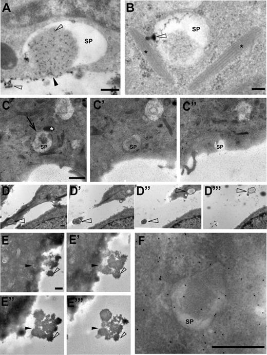 Figure 6. Secretory pods can connect to the extracellular space. (A-B) Lanthanum was used as a tracer of extracellular spaces. Precipitates of lanthanum, which are present as opaque speckles (open arrowheads), have mixed with the content of the SP shown in this example. The SP appears to have fused with the plasmamembrane (black arrowhead). Scale bar represents 100 nm. (B) The SP in this example shows a funnel-shaped protrusion (open arrowhead) that is filled with lanthanum precipitate and connects to a WPB close by (WPBs are indicated with asterisks). The funnel-shaped structure may correspond to fused nanovesicles. Scale bar represents 100 nm. (C,C′,C″) Consecutive sections of 150-nm thickness, through an SP that in panel C″ opens up into the extracellular space via an omega-shaped figure. The SP is in contact with a WPB (white asterisk in panel C) and displays a clathrin-coated pit (arrow in C). Scale bar represents 1 μm. (D-D‴) Consecutive sections through 2 SPs (open arrowheads). In panel D‴, the SP at the top is surrounded by only a small rim of the cell surface, suggesting that the plasma membrane forms an elevation around the exit site, that is, secretion pore, of the SP. Scale bar represents 500 nm. (E,E′,E″,E‴) Consecutive sections through a secretory pod (black arrowhead in panel E) in a HUVEC that was secretagogue-challenged in the presence of anti-VWF antibodies to generate electron-dense globules of VWF (open arrowhead). The position of the SP in panel E is indicated in the consecutive sections E′ through E‴. Note that the VWF globules emanate from the SP. Scale bar represents 1 μm. (F) Enlargement of the SP shown in panel E. Scale bar represents 500 nm. (C-C″,E-F) The small speckles in panels C to C″ and panels E and F represent gold particles used as fiducial markers for electron tomography. Electron micrographs and tilt series were acquired with an FEI Tecnai 12 TEM at 120 kV and using an FEI Eagle 4kx4k CCD camera.