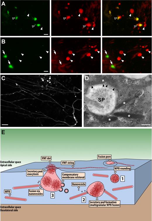 Figure 7. Secretory pod formation induced by thrombin. HUVECs were secretagogue challenged for 10 minutes with thrombin at a concentration of 1 U/mL. (A-B) Examples of VWF dots revealed by labeling with 2 distinct VWF antibodies, the first applied during secretagogue challenge (green channel, left panels) and the second after fixation and permeabilization (red channel, middle panels). The right panels depict the overlays of the green and red channels. Closed arrowheads indicate VWF dots that were not accessible to the extracellular anti-VWF antibodies (ie, nonfused SPs), open arrowheads indicate partially accessible VWF dots (ie, fused SPs), and arrows indicate fully accessible VWF dots. Scale bar is 2 μm. (C) Example of VWF strings and VWF dots induced by thrombin stimulation in the absence of VWF antibodies. VWF labeling was performed only after fixation and permeabilization. Scale bar represents 5 μm. Microscopy and fluorochromes used were as described in Figure 1 legend. (D) Electron micrograph of a thrombin-induced SP. Asterisks indicate WPBs clustering around or making close contact with the pod. Notice in particular the top WPB that appears to be docking lengthwise onto the pod (arrowheads). Scale bar represents 0.5 μm. Microscopy was as described in Figure 2 legend. (E) Hypothetical model summarizing the data presented herein. Secretagogue challenge of HUVECs induces multigranular exocytosis of WPBs. The initial event leading to this process may be WPB rounding (1), although WPB rounding has also been implicated in lingering-kiss exocytosis. Coalescence of WPBs is mediated by nanovesicles and leads to the formation of intracellular secretory pods (2). Subsequent fusion of the secretory pods with the plasma membrane results in secretory pod exocytosis (3). VWF is released via the fusion pore of the SPs. The delimiting membrane of the SPs is reinternalized via clathrin-mediated compensatory membrane retrieval. WPBs may continue to fuse with multigranular aggregates that have already undergone exocytosis.
