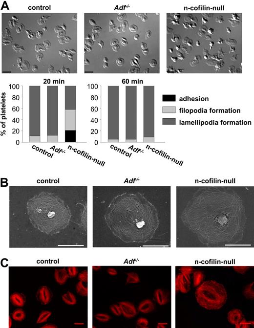 Figure 2. Delayed spreading of n-cofilin–null, but not Adf−/− platelets on fibrinogen. (A) Thrombin-activated (0.001 U/mL) platelets were allowed to spread on immobilized human fibrinogen (1 mg/mL). Platelets were fixed at different time points and counted. Differential interference contrast images were recorded after 20 minutes. Bar represents 4 μm. (B) SEM after plasma membrane denudation of platelets spread for 60 minutes on fibrinogen. Scale bar represents 2 μm. (C) STED microscopy of platelets spread for 60 minutes on fibrinogen and stained with phalloidin. Scale bar represents 3 μm.