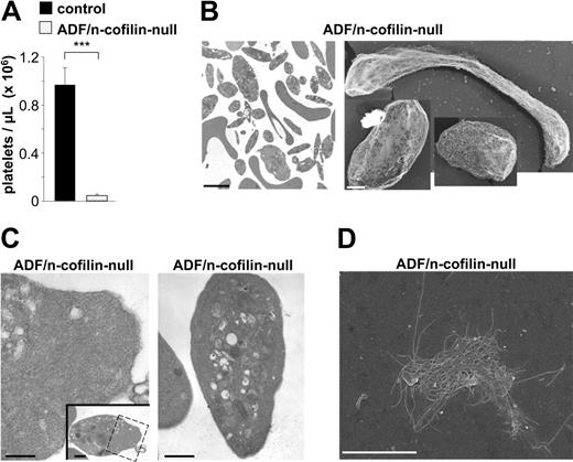 Figure 3. Markedly reduced peripheral platelet counts and abnormal platelet ultrastructure in ADF/n-cofilin–null mice. (A) Peripheral platelet counts were determined by flow cytometry. Results are mean ± SD (n = 6). ***P < .001. (B left, C) TEM analysis of resting platelets. Boxed area in panel C shows accumulation of filamentous material (see also higher magnification). (B right) Visualization of the cytoskeleton of resting platelets on poly-L-lysine. (D) SEM after denudation of the membrane of an ADF/n-cofilin–null platelet spread for 60 minutes on fibrinogen. Scale bars represent 2 μm (B left, D), 1 μm (B right), and 0.5 μm (C).