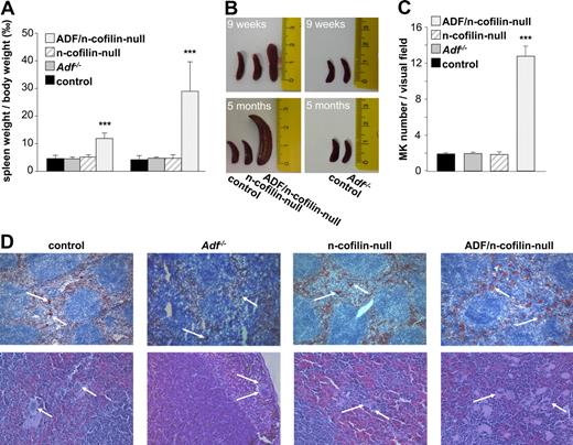 Figure 5. Splenomegaly and elevated MK numbers in ADF/n-cofilin–null mice. (A) Spleen and body weight was measured after 9 weeks or after 5 months. Results are mean ± SD (n = 6). ***P < .001. (B) Representative spleens are shown from 9-week- or 5-month-old mice. Scale of ruler is in centimeters. (C) Numbers of MKs per visual field (328 × 246 μm) of hematoxylin and eosin stainings were determined. ***P < .001. (D) Cryo- (top panel, visual field: 1310 × 983 μm) or paraffin-embedded (bottom panel, visual field: 328 × 246 μm) sections (5 μm) were stained with anti-GPIb-HRP/hematoxylin and hematoxylin/eosin, respectively. White arrows represent MKs.