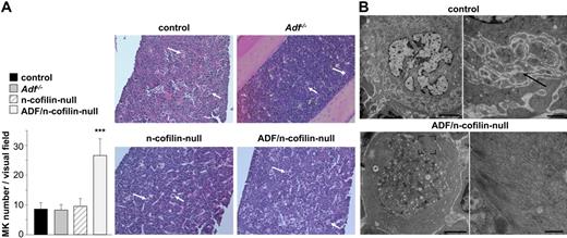 Figure 6. Morphologic abnormalities in bone marrow MKs of ADF/n-cofilin–null mice. (A) Paraffin-embedded sections (5 μm) were stained with hematoxylin and eosin (visual field: 655 × 491 μm). White arrows indicate MKs. Numbers of MKs per visual field (328 × 246 μm) were determined. ***P < .001. (B) TEM of control and ADF/n-cofilin–deficient bone marrow MKs. Right image (higher magnification of left image) of control MKs shows the DMS (black arrow). In ADF/n-cofilin–deficient bone marrow MKs, high amounts of fibrillar material are present in the peripheral cytoplasm (see higher magnification of the boxed area). Note that this zone is clearly devoid of organelles. Scale bars represent (from left to right) 5 and 1 μm (control), and 2 and 0.5 μm (ADF/n-cofilin–null).