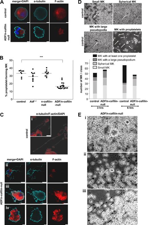 Figure 7. Reduced proplatelet formation and absence of swellings in ADF/n-cofilin–null MKs. Fetal liver cells of embryos at day 14.5 were prepared and cultured in medium containing 50 ng/mL TPO. On day 4, MKs were stained (A,C). Control (Ci), ADF/n-cofilin–null (Cii-iv). Scale bars represent (A) = 10 μm, (Ci) = 50 μm, (Cii-iii) = 25 μm, (Civ) = 10 μm. (B) Fetal liver cells were cultured for 4 days and MKs were analyzed for proplatelet formation under a light microscope using a 20× objective. (●) Average of 20 analyzed visual fields per fetal liver-derived MK culture. The horizontal bars represent the arithmetic mean of each group. ***P < .001. (D) Bone marrow sections (0.5-mm-thick) were incubated with Tyrode buffer supplemented with 5% mouse serum at 37°C. Representative pictures of small MKs, spherical MKs, MKs with protrusion, and MKs with proplatelets are shown. Quantification was performed after 3 and 6 hours of incubation. Arrows indicate MKs (small MKs, spherical MKs, MKs with large pseudopodia). Arrows indicate swellings (MKs with proplatelets). (E) Representative images of bone marrow explants from ADF/n-cofilin–null mice after 6 hours of culture. The morphologies of spherical MKs (i) and proplatelet-like extensions (ii) were compared with control (see also control MKs in panel D) and analyzed. (i) Arrow indicates the MKs. (ii) Arrow indicates short extension of the MKs. (iii) Isolated extensions (black arrows) of ADF/n-cofilin–null MK were observed in the chamber.
