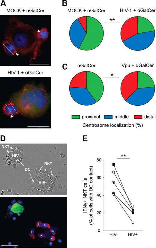 Figure 3. CD1d down-regulation inhibits activation of CD1d-restricted NKTcells. (A) NKT cells were coincubated with αGalCer-loaded MOCK- or 81A-EGFP (green) infected DCs. Cell complexes were fixed, permeabilized, and stained with anti–α-tubulin mAb (red) and DAPI (4,6 diamidino-2-phenylindole; blue). White arrowheads indicate centrosomes; white lines show division of NKT cells for quantification of centrosome polarization. (B) Percentage of centrosomes located proximal, middle, or distal to the site of NKT-DC contact. At least 35 complexes in 2 experiments were analyzed; **P = .001. (C) As in panels A and B, but NKT cells were coincubated with αGalCer-loaded MOCK- or Vpu-transfected 293T-CD1d cells. At least 70 complexes in 2 experiments were analyzed; *P < .05. (D) Staining with anti–IFN-γ mAb (red) was performed after coincubation of NKT cells with αGalCer-loaded 81A-EGFP (green) infected DCs for 2 hours in the presences of brefeldin A. Minuses indicate IFN-γ negative, asterisks IFN-γ positive NKT cells in contact with DCs. (E) Quantification of IFN-γ production in 5 independent experiments with DCs from different donors. **P < .01. Scale bars, 15 μm.