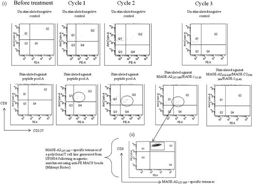 Figure 6. Characterization of MAGE-specific CTL response induced by AZA/VPA treatment in patient no. UPIN04. (i) Flow cytometry plots after magnetic enrichment of patient no. UPIN04 before and after treatment. A total of 2 × 106 PBMCs were stimulated with peptide, of which flow cytometric analysis revealed 35.2% to be CD3+CD8+. From these 594 000 CD8+ T cells, 23 cells were isolated in the positively selected fraction, validating the assay. Fifteen peptides derived from a range of the CTAs MAGE-A1/A2/A3, MAGE-C2, BAGE, and RAGE (Alta Bioscience, for CD8 peptides) were chosen from previously described epitopes for CD8+, restricted by a variety of human leukocyte antigen alleles (supplemental Table 2). These peptides were chosen on the basis that previous publications have shown expression of MAGE, BAGE, and RAGE in tumor biopsy samples from AML patients by reverse transcription–polymerase chain reaction.16 In cases in which the patient's human leukocyte antigen type was unknown, PBMCs were screened initially against peptide pools, and the response to single peptides was elicited on subsequent analysis and confirmed by human leukocyte antigen type (http://www.cancerimmunity.org/peptidedatabase/tumorspecific.htm). (ii) Flow cytometry analysis with a MAGE-A2157-166 tetramer stain of a T-cell line generated from patient no. UPIN04 after magnetic enrichment with anti-PE magnetic beads (Miltenyi Biotec).