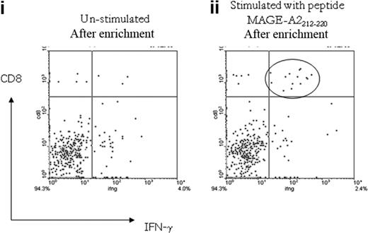 Figure 7. Analysis of MAGE-A2212-220–specific CD8+ T-cell response detected in patient no. UPIN18 with the IFN-γ cytokine secretion and enrichment assay. Fluorescence-activated cell sorter plot (i) shows the number of CD8+ IFN-γ–secreting T cells detected in the unstimulated sample after magnetic enrichment compared with the sample stimulated with the MAGE-A2212-220 peptide (ii).