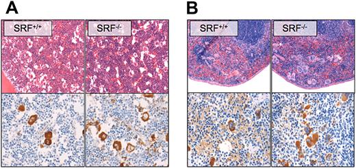 Figure 3. Megakaryocyte morphology and localization. Representative BM (A) and spleen (B) sections of Pf4/Srf WT and KO mice were stained with hematoxylin and eosin (top) and anti-VWF (bottom). Representative images of at least 3 mice are shown.