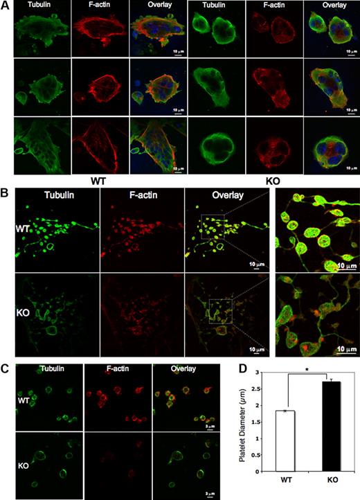 Figure 5. Megakaryocyte, proplatelet, and platelet cytoskeletal structure. Megakaryocytes from Pf4/Srf WT and KO mice were cultured in TPO containing medium for 4 days and subsequently plated on fibronectin-coated coverslips and stained for tubulin (green) and F-actin (phalloidin, red). 4,6′-diamidino-2-phenylindole was used to stain DNA. (A) Representative images of WT (left) and KO (right) megakaryocytes. (B) Representative images of WT (top) and KO (bottom) megakaryocytes forming proplatelets in culture. (C) Platelets from 3 Pf4/Srf WT and 3 Pf4/Srf KO mice were fixed, spun onto coverslips, and stained for tubulin and F-actin. (D) WT (n = 29) and KO (n = 34) platelet size were measured in micrometers. *P < .01.