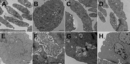 Figure 6. Transmission electron microscopy of megakaryocytes and platelets. Representative electron microscopic views of platelets and cultured megakaryocytes of Pf4/Srf WT and KO mice. Pf4/Srf KO mice contain a population of giant platelets, and Pf4/Srf KO megakaryocytes have structural alterations. (A) Representative image of a normal population of platelets from a WT mouse. (B-D) Electron micrographs showing giant platelets isolated from the blood of Pf4/Srf KO mice. Scale bar represents 500 nm (A-D). (E) Representative image of a normal megakaryocyte with a well-structured, uniform demarcation membrane system from WT mouse. (F-H) Electron micrographs of megakaryocytes with altered structures from Pf4/Srf KO mice. A small area of demarcation membrane system concentration, resembling a maze of small tubules, is observed in a population of Srf-deficient megakaryocytes (F-G). (H) Representative Pf4/Srf KO megakaryocyte micrographs in which the cellular contents are not evenly distributed throughout the cytoplasm, including areas with missing granules and organelles. Scale bar represents 2 μm (E-H).