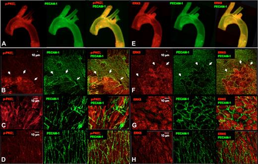Figure 6. PKCζ activation and ERK5 expression in the ApoE−/− mouse. Aortas from 12-week-old ApoE−/− mice were harvested for qualitative analysis of PKCζ activation (A-D red) and ERK5 expression (E-H red). The differential PKCζ activation or ERK5 expression is evident in the images of the whole aortic mount (4× lens; A,E), in the en face analysis of the aortic arch (20× lens; B,F), and specifically in the athero-prone (C,G; 60× lens) and athero-protected (D, H; 60× lens) areas of the aortic arch. EC morphology was changed in the early atherosclerosis regions (B,F; arrowheads) where ECs are stretched and may have lost PECAM-1 staining (green) at some cell junctions. Bar = 10 μm.