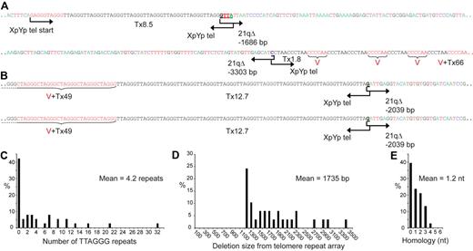 Figure 4. Telomere fusion occurs between very short telomeres and is characterized by extensive deletion and microhomology at the fusion point. (A) DNA sequences of 2 telomere fusion events involving the XpYp and 21q telomeres obtained from CLL B cells. Microhomology at the fusion point is underlined and bold. The amounts of TTAGGG repeats and variants are denoted as T (black) and V (red), respectively. Deletion size (bp) is indicated. (B) DNA sequence of a clonal fusion event. Two identical sequences were from separate fusion molecules obtained from the same patient. (C) Histogram summarizing the amount of contiguous TTAGGG repeats adjacent to the fusion point. (D) Summarizing the amount of deletion into the telomere-adjacent DNA determined from the start of the telomere repeat array. (E) Summarizing the amount of 100% homology between the fusion partners at the fusion junction. Additional homology is observed adjacent to the fusion point (supplemental Figure 3).