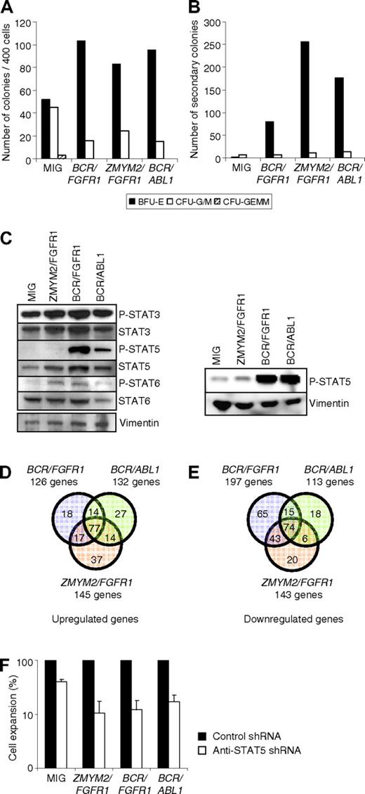 Figure 2. Expression of ZMYM2/FGFR1, BCR/FGFR1, or BCR/ABL1 in human CD34+ CB cells leads to expansion of erythroid colonies and induces similar but distinct gene-expression profiles. (A) Cells expressing ZMYM2/FGFR1, BCR/FGFR1, or BCR/ABL1 mainly gave rise to BFU-E colonies after 2 weeks of culture in methylcellulose medium. (B) After replating of colonies, cells expressing a fusion gene almost exclusively formed BFU-E colonies. One representative experiment of 4 is shown. (C) Western blot analysis of STAT phosphorylation after 6 days suspension culture showing that ZMYM2/FGFR1 induced a much lower level of STAT5 phosphorylation than BCR/FGFR1 or BCR/ABL1 (left panel). The right panel shows an independent Western blot analysis, using longer exposure time, in which a weak but distinct band of phosphorylated STAT5 in ZMYM2/FGFR1-expressing cells is observed. Vimentin was used as an endogenous control for equal loading. (D-E) Venn diagrams showing the number of genes that are differentially expressed and commonly regulated in cells expressing ZMYM2/FGFR1, BCR/FGFR1, or BCR/ABL1 compared with MIG control cells. (F) Cells co-expressing ZMYM2/FGFR1, BCR/FGFR1, or BCR/ABL1 and an anti-STAT5 shRNA showed a significant reduction in cell proliferation after 7 days in suspension culture. The data are displayed as the mean cellular expansion for the anti-STAT5 shRNA-expressing cells in percentage of the corresponding control scramble shRNA-expressing cells from 3 separate experiments, with error bars representing SD.
