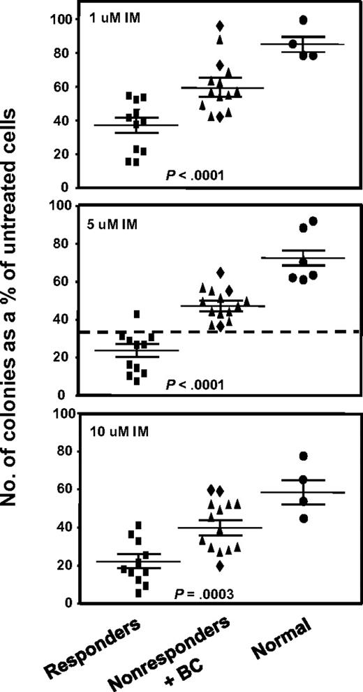 Figure 1. Comparison of the effect of different concentrations of IM on colony formation by CFCs from IM responders and nonresponders. CD34+ cells from 11 patients classified clinically as imatinib mesylate (IM) responders and 14 as nonresponders were assayed in duplicate 1-mL methylcellulose cultures containing 0, 1, 5, or 10μM IM. Two weeks later, the colonies were enumerated to determine the numbers derived from BFU-E, CFU-GEMM, or CFU-GM. The total number of colonies obtained in the IM-supplemented cultures was then calculated as a percentage of those obtained in the absence of IM. (♦) Results obtained from the 3 patients who rapidly developed BC; and cross bars, mean plus or minus SEM of data for each patient group. Differences between the results for the IM responders and nonresponders at all doses of IM tested are significant (P < .001).