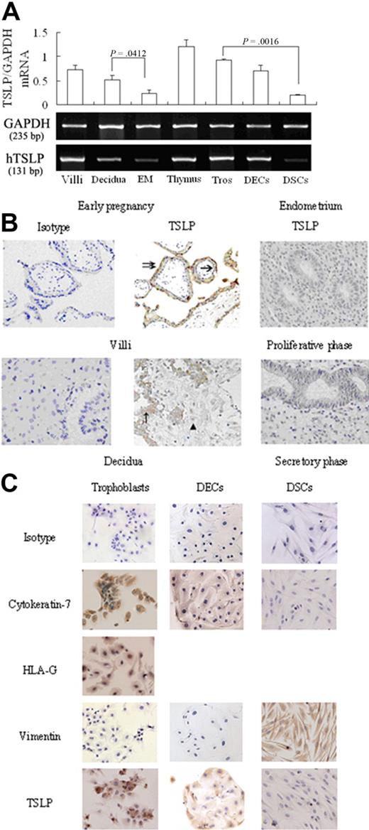 Figure 1. TSLP is expressed at human maternal-fetal interface in the early pregnancy. TSLP expression was evaluated by RT-PCR (A), immunohistochemistry (B), and immocytochemistry (C). Both villi and decidua from the early pregnancy and endometrial tissues from nonpregnant women expressed TSLP mRNA. The primary human trophoblasts (Tros), DECs, and DSCs also expressed TSLP mRNA (A). TSLP protein was localized in the cytoplasm of Tros (single arrow, cytotrophoblast cells; double arrow, syncytiotrophoblast cells) in villi and the cytoplasm of DECs (↑) in decidua (B), but absent in DSCs (▴). TSLP protein could not be detected in endometrium of the nonpregnancy, including proliferative and secretory phase (B). These results were further confirmed in the primary trophoblasts, DECs, and DSCs (C). Data are mean ± SD. The experiments were repeated 4 times with 4 placenta, decidua and endometrial tissue samples, respectively. The picture is a representative one.