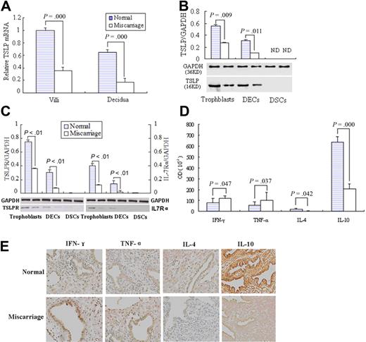 Figure 7. Higher TSLP and its receptor expression and TH2 bias at maternal-fetal interface in the early pregnancy than miscarriage. Quantitative PCR shows that TSLP expression in villi and decidua from placenta of normal early pregnancy was significantly higher than that of unexplained miscarriage (A). Western blot analysis of TSLP, TSLPR, and IL-7Rα in freshly isolated trophoblast cells, DSCs, DECs, and DSCs from normal early pregnancy and unexplained miscarriage was performed (B-C). The bands were scanned and analyzed on Las-300 (FujiFilm), and the ratio of TSLP, TSLPR, or IL-7Ra to GAPDH indicates the relative protein levels in each group, respectively. The TH1 cytokines, IFN-γ and TNF-α, or TH2 cytokines, IL-4 and IL-10, at the maternal-fetal interface were evaluated by immunohistochemistry (D). Histogram shows the relative expression level of the indicated cytokines as determined by densitometric analysis (E). Data are mean ± SD from 4 repeated experiments with 4 placenta samples, respectively. Original magnification in the representative results is 200-fold (E).