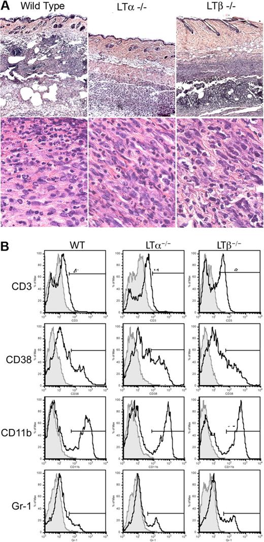 Figure 4. Massive leukocytic infiltrates at immunization sites in the skin. (A) Hematoxylin and eosin staining of the skin at the site of immunization with ovalbumin and CFA on day 7 reveals cellular infiltration of the skin. (original magnifications 5× or 100× oil objective; Zeiss Axioscope). (B) FACS analysis of cells isolated from skin site of immunization reveals consistently increased proportions of macrophages and granulocytes in skin from LTβ−/− mice (representative of 4 experiments at days 4 and 7; n = 4 mice per group).
