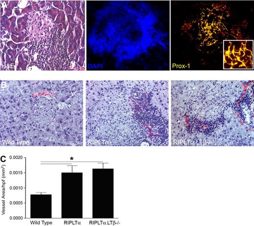 Figure 5. Lymphatic vessels associated with tertiary lymphoid organs in the pancreas induced by ectopic expression of LTα. (A) H&E, DAPI, and Prox1 staining of 1-year-old RIPLTα pancreas (40× objective; Zeiss Axioscope). (B) Merge of peri-islet bright field staining for hematoxylin and dark field for LYVE-1 positive lymphatic vessels (red) in the pancreas. More lymphatic vessels are associated with TLOs around the islets of RIPLTα and RIPLTαLTβ−/− mice than WT mice (n = 3 per group; 20× objective; Zeiss Axioscope). (C) Morphometric quantification reveals a significant increase in peri-islet LYVE-1 positive vessel area in the pancreata of RIPLTα and RIPLTαLTβ−/− mice compared with WT mice (*P < .05). No significant difference in LYVE-1 positive vessel area was found between RIPLTα and RIPLTαLTβ−/− pancreata.