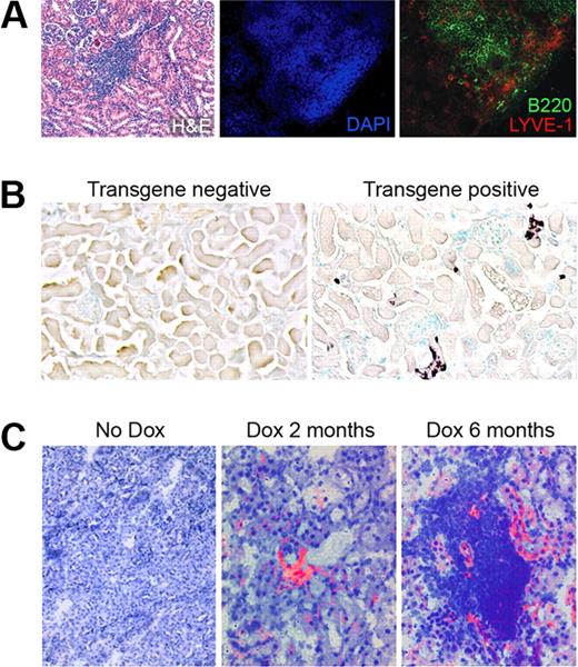 Figure 6. Lymphatic vessels are apparent before obvious TLOs. (A) H&E, DAPI, B220, and LYVE-1 staining in the kidney of a RIPLTα mouse (40× objective; Zeiss Axioscope). LYVE-1 positive lymphatic vessels (red) are within and around B cell regions (green) of the TLO. (B) In situ hybridization reveals LTα expression (dark purple) in the convoluted tubules of a RIPLTαTetOn mouse kidney after 1 month of doxycycline feeding (20× objective; Zeiss Axioscope). (C) Merge of bright field staining for hematoxylin and dark field for LYVE-1 positive vessels (red) reveals lymphatic vessels within kidney parenchyma after 2 months of doxycycline feeding before apparent extensive leukocytic infiltration. At 6 months, TLOs are apparent in the kidney with more obvious lymphatic vessels Cy-2 green LYVE-1 staining has been digitally colorized red to enhance contrast against hematoxylin (original magnification ×40; Zeiss Axioscope).