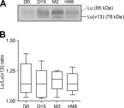 Figure 3. Erythroid expression of Lu and Lu(v13) during HU treatment. Lu and Lu(v13) were immunoprecipitated and revealed by WB. (A) Typical result showing the presence of Lu (85 kDa) and Lu(v13) (78 kDa) before and during HU treatment. (B) Box and whiskers represent the Lu/Lu(v13) ratio of 5 pre-post group patients during HU treatment; internal horizontal line, median; lower and upper box limits, 25th and 75th percentiles; and T-bars, range.