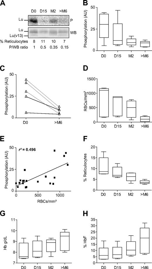 Figure 4. Lu/BCAM phosphorylation (P), RBC adhesion, and evolution of 3 blood parameters during HU treatment. (A) Typical results (1 of 5 experiments) obtained with pre-post group patient's SS RBCs showing the phosphorylation of the Lu-gp long isoform after RBC radiophospholabeling and immunoprecipitation of Lu/BCAM. The percentage of reticulocytes was determined by flow cytometry of each sample. Total immunoprecipitated Lu/BCAM proteins were quantified by WB. The P/WB ratio estimates the proportion of phosphorylated proteins. (B) Box and whiskers represent Lu/BCAM phosphorylation in 5 patients before (D0) and during HU treatment (D15, M2, and > M6); internal horizontal line, median; lower and upper box limits, 25th and 75th percentiles; and T-bars, range. HU significantly decreased Lu/BCAM phosphorylation (P = .005; Friedman test, AU indicates arbitrary units). (C) Lu/BCAM-phosphorylation change after 6 months of HU treatment for each of the 5 patients. (D) Evolution of RBC adhesion under treatment for the 5 HU-treated patients. (E) A linear-regression analysis between RBC adhesion and Lu/BCAM phosphorylation (P < .001, r2 = 0.496). (F-H) Box and whiskers represent the evolution of reticulocyte percentages, Hb concentrations and HbF percentages, respectively.