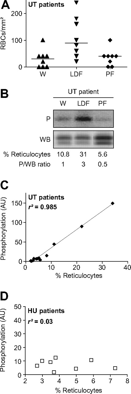 Figure 5. RBC adhesion to laminin at 0.4 dyne/cm2 and Lu/BCAM phosphorylation (P) after blood fractionation. (A) Adhesion of UT RBCs from whole blood (W), the reticulocyte-rich low-density fraction (LDF), and the pellet containing the mature RBC-rich fraction (PF). Horizontal lines are medians. More LDF cells adhered than those from W (P < .01) or the PF (P < .05; Friedman test). (B) Typical results (1 of 5 experiments) showing the phosphorylation of the Lu-gp long isoform in W, LDF, and PF of an UT patient. The percentage of reticulocytes was determined by flow cytometry for each sample. Total immunoprecipitated Lu/BCAM proteins were quantified by WB. P/WB ratio estimates the proportion of phosphorylated proteins. (C) Linear regression between phosphorylation and reticulocyte percentage in UT patients (r2 = 0.985, P < .001, n = 5 patients, 3 samples for each patient: W, LDF, and PF). (D) Lu/BCAM phosphorylation as a function of the reticulocyte percentage in 8 HU-treated patients (r2 = 0.03, P = .66, n = 8).