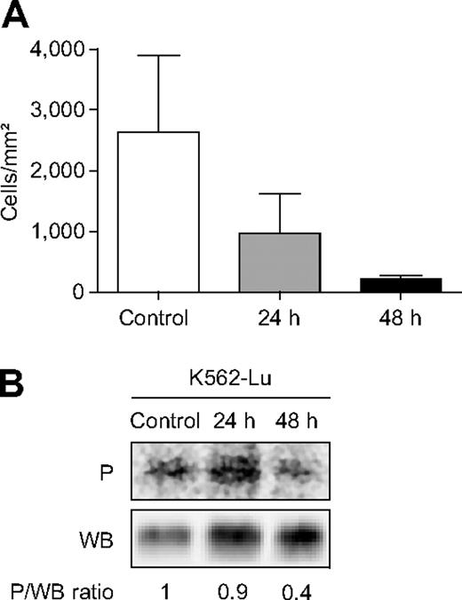 Figure 6. Adhesion of K562-Lu cells to laminin and Lu-gp phosphorylation (P) during exposure to HU. (A) Data are mean ± SEM values of K562-Lu cells adhering to laminin at 2 dyn/cm2 before (Control) and after 24 and 48 hours of exposure to 250μM HU (n = 3). (B) Lu-gp phosphorylation of HU-treated K562-Lu cells (typical result); data (mean ± SEM) at 24 and 48 hours were 0.75 ± 0.27 and 0.27 ± 0.1, respectively (n = 3). HU exposure reduced K562-Lu adhesion to laminin and Lu-gp phosphorylation.