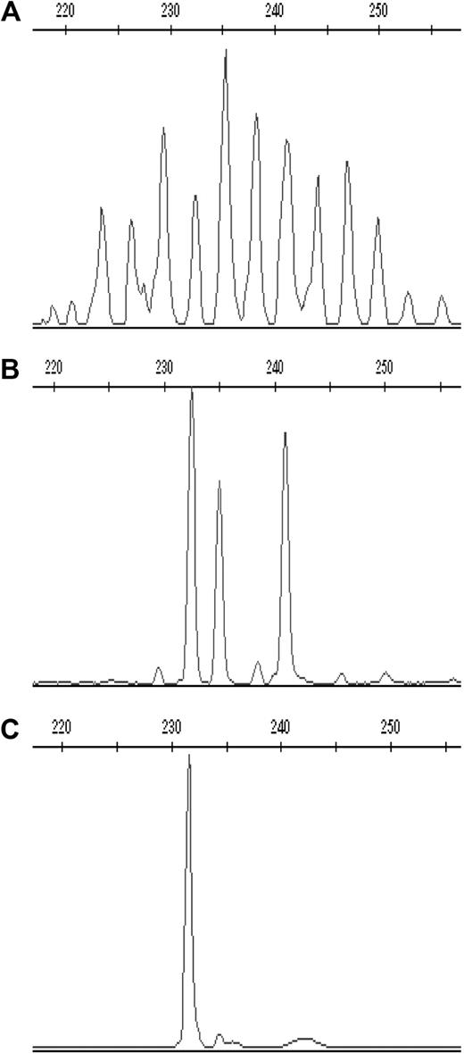 Figure 5. Representative CDR3 spectratype profiles of the TCR-δ chain in one CMV-seropositive healthy donor. Profiles of (A) polyclonal, (B) oligoclonal, and (C) monoclonal CDR3 spectratype for Vδ3 cells are shown expressed as relative fluorescent intensity versus the CDR3 length size.