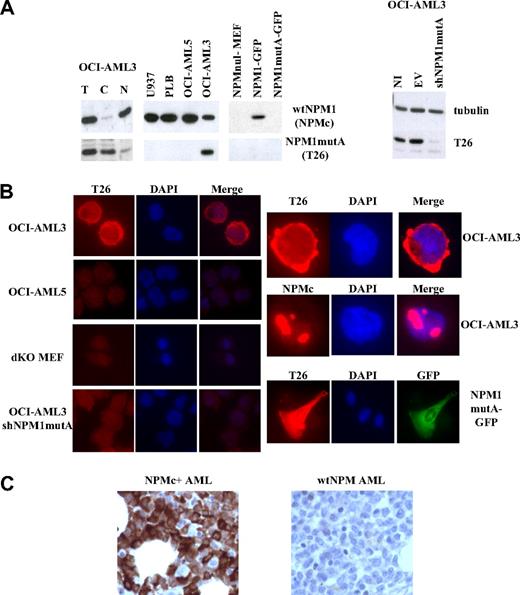 Figure 1. Validation of the T26 mAb. (A) Western blotting analysis of cells expressing or not the NPM1mutA protein. Lysates from the indicated cell lines were analyzed using mAbs specific to NPM1mutA (T26), wt NPM1 (NPMc), or tubulin β (Santa Cruz Clone H-235). (Left panel) Total lysates (T) were fractionated into cytoplasmic (C) or nuclear (N) fractions. (Right panel) Lysates were prepared from not infected OCI-AML3 cells (NI) or the same cells after infection with lentiviral vector expressing (shNPM1mutA) or not (empty vector; EV) shRNAs against NPM1mutA. (B) IF analysis of the indicated cell lines with the specified antibodies (T26 or NPMc). Staining with T26 or NPMc, DAPI staining, and merged channels (Merge) are shown. Original magnifications: left panels, ×600; right panels, ×1000. (C) IHC of bone marrow trephine biopsy sections from NPMc+ AML (left) or wt NPM AML (right) patients.