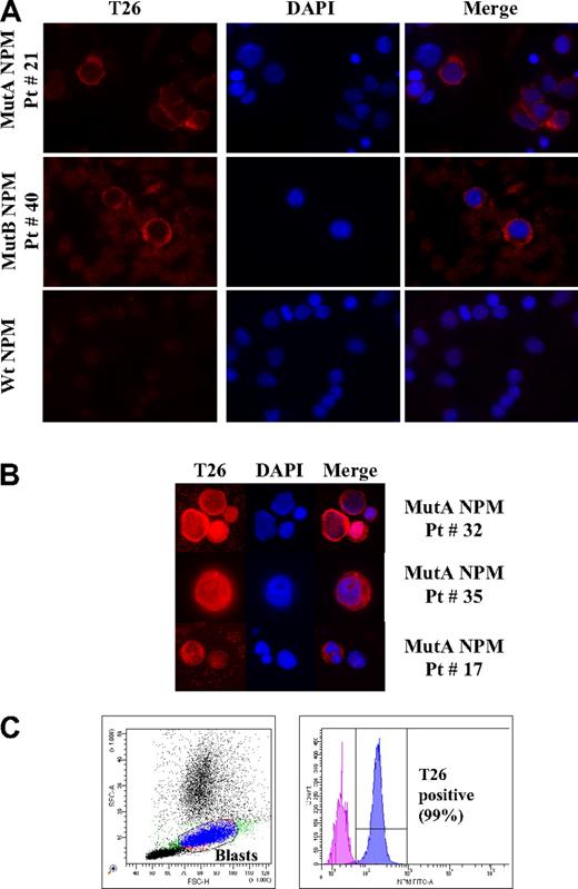 Figure 3. IF and flow cytometric analyses of AML patient samples using the T26 mAb. (A) Representative IF images of bone marrow cells from type A (top panel), type B (middle panel), NPMc+ AML or wt NPM1 AML (bottom panel) patients, as indicated. Patient identification numbers are indicated as in Table 1. (B) Representative IF images of NPMc+ blasts with nuclear + cytoplasmic (top panels) or nucleolar + cytoplasmic (middle panels), and cytoplasmic T26 staining in NPMc+ leukemic cells with segmented nuclei (bottom panels). T26 staining, DAPI staining, and merged channels (Merge) are shown. (C) Representative example of flow cytometric analysis of a bone marrow sample from an NPMc+ AML patient (Pt # 10). Dot-plot showing the blast gate set on forward scatter/side scatter (left) and the histogram displaying the fluorescence of cells within the blast gate (right). Patients' lymphocytes present in the sample were used as a negative control.