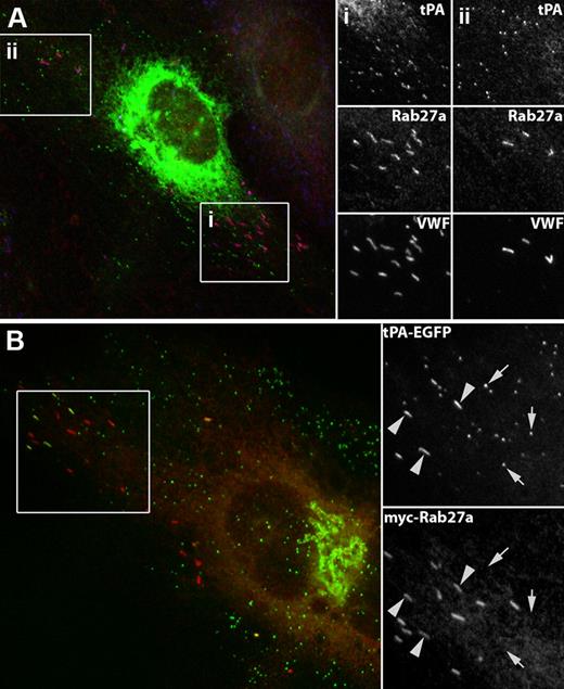 Figure 2. The tPA-EGFP-containing organelle does not recruit endogenous or expressed Rab27a. (A) An individual HUVEC triple labeled with specific antibodies to tPA (green), Rab27a (red), and VWF (blue). Grayscale images of the regions i and ii are shown on the right. (B) Twenty-four hours after Nucleofection with tPA-EGFP (green; EGFP fluorescence) and myc-Rab27a (red). tPA-EGFP is seen in Rab27a-negative puncta and also occasionally in some WPBs, identified by their distinctive rod-shape (large arrowheads). (A-B) Grayscale inserts: regions indicated by white boxes on the color images.