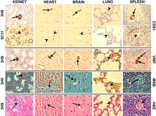 Figure 5. Histopathologic analysis confirms disseminated platelet- and VWF-rich aggregates in multiple organs. Tissue sections of kidney, heart, brain, lung, and spleen (indicated above the panel) were prepared and stained as shown to the right; hematoxylin and eosin (H&E), immunohistochemical staining for platelet antigen CD61 and for VWF as well as a Martius yellow, Brilliant crystal scarlet 6R, and Soluble blue (MSB) stain for fibrin. The MSB stain colors both muscle and fibrin bright red and erythrocytes yellow/orange, and nuclei and connective tissue stains blue/purple. Arrows indicate thrombi, and arrowheads indicate open vessels. Original magnification (all panels) ×400.
