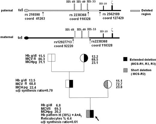 Figure 1. Family pedigree, hematologic data, and schematic representation of the telomeric region of paternal and maternal chromosome 16 (p16.3). The common deletion or nondeletion defects in the proband and in his parents, and the presence of hyper-unstable alpha-globin variants were excluded with conventional DNA analysis technique (GAP-PCR and alpha-gene sequencing). Multiplex ligation-dependent probe amplification (MLPA) of the extended alpha-globin gene cluster using a set of 25 probes covering a region of 170 kb in the alpha-cluster (MRC-Holland)4 detected the deletion of the 2 MCS-R2 region probes (coordinates ligation site 103553-54 and 103712-13, respectively) in homozygosity in the proband, suggesting the complete lack of MCS-R2 region, and in heterozygosity in his parents. In the proband and in his father, MLPA analysis revealed a deletion extending up to the first telomeric probe (coordinates ligation site 43321-22), located on POL3K gene, suggesting the removal of the telomere.10 Family segregation studies of SNPs along the telomeric region of chromosome 16 (coordinates from 41263 to 127429, according GenBank accession number AE006462.1) showed in the father an apparent homozygosity and absence of Mendelian segregation for rs216590 (coord 41263) and for rs2238368 (coord 110328) polymorphisms, whereas the rs2562189 (coord 127429) was heterozygous. These data are indicative of a deletion extending at least from the telomere to rs2238368 (coord 110328), which caused the loss of MCS-R1, MCS-R2, and MCS-R3 regions. We could not define the centromeric breakpoint of the deletion. The same deletion was identified in the paternal grandmother. In the mother, heterozygosity for rs12927713 (coord 92220) and rs22388368 (coord 110328) suggested a smaller deletion. The direct sequencing of the rearranged fragment, obtained with a GAP-PCR using 2 primers flanking the deletion, allowed us to exactly define the extension (3361 bp), the breakpoints (5′ at 103192/3 and 3′ at 106553/4 position), and the presence of 39 orphan nucleotides.