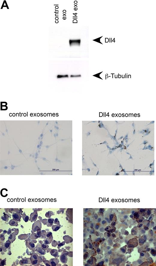 Figure 4. Dll4 is transferred to other cells via exosomes. (A) U87GM cells were seeded onto 6-well plates at 3 × 105/well. The cells were then incubated with either control exosomes (50 μg/mL) or Dll4-containing exosomes (50 μg/mL) in Opti-Mem for 24 hours before extensive washing with PBS and lysis in radioimmunoprecipitation assay buffer. Lysates were subjected to Western blotting and were probed with either anti-Dll4 or β-tubulin as a loading control. Exo indicates exosomes. (B) The same experiment was repeated, except the cells were fixed in acetone after the 24-hour incubation. They were then stained with anti-hDll4. Images were taken on a Nikon Eclipse E800 microscope at 40× magnification. (C) U87 cells incubated with exosomes (50 μg/mL) for 24 hours were pelleted, embedded, and sectioned. The sections were then stained with anti-hDll4, and images were taken at 50× magnification with a Nikon Eclipse E800 microscope.